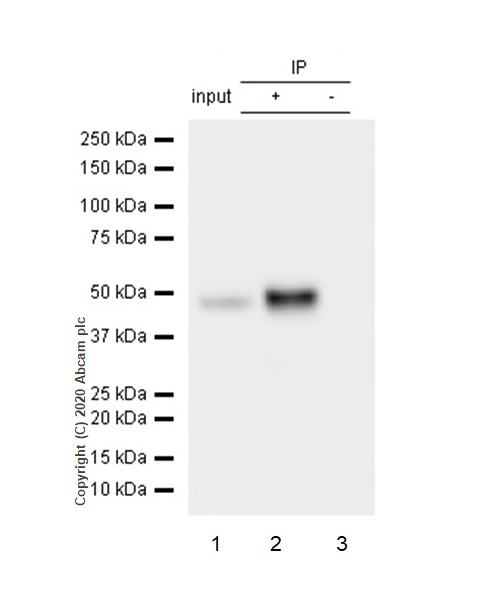 Immunoprecipitation - Anti-Cytokeratin 14 antibody [EP1612Y] - BSA and Azide free (AB243907), expandable thumbnail