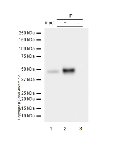 Immunoprecipitation - Anti-Cytokeratin 14 antibody [EP1612Y] - BSA and Azide free (AB243907)