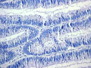 Immunohistochemistry (Formalin/PFA-fixed paraffin-embedded sections) - Anti-Cytokeratin 14 antibody [EPR1612] (ab108417), expandable thumbnail