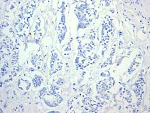 Immunohistochemistry (Formalin/PFA-fixed paraffin-embedded sections) - Anti-Cytokeratin 14 antibody [EPR1612] (ab108417), expandable thumbnail
