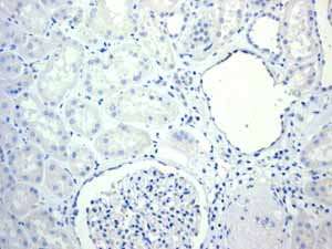 Immunohistochemistry (Formalin/PFA-fixed paraffin-embedded sections) - Anti-Cytokeratin 14 antibody [EPR1612] (ab108417), expandable thumbnail