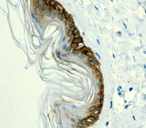 Immunohistochemistry (Formalin/PFA-fixed paraffin-embedded sections) - Anti-Cytokeratin 14 antibody [EPR1612] (ab108417), expandable thumbnail