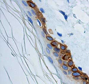 Immunohistochemistry (Formalin/PFA-fixed paraffin-embedded sections) - Anti-Cytokeratin 14 antibody [EPR1612] (ab108417), expandable thumbnail