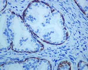 Immunohistochemistry (Formalin/PFA-fixed paraffin-embedded sections) - Anti-Cytokeratin 14 antibody [EPR1612] (AB108417), expandable thumbnail