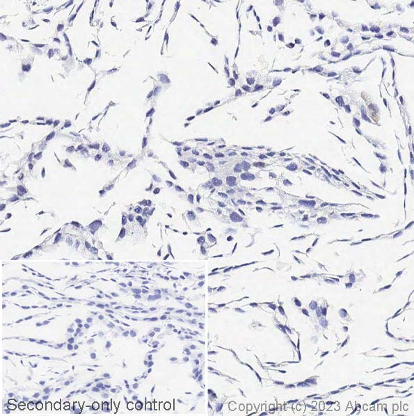 Immunohistochemistry (Formalin/PFA-fixed paraffin-embedded sections) - Anti-Cytokeratin 14 antibody [EPR1612] (AB108417), expandable thumbnail