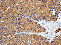 Immunohistochemistry (Formalin/PFA-fixed paraffin-embedded sections) - Anti-Cytokeratin 14 antibody [EPR1612] (AB108417), expandable thumbnail