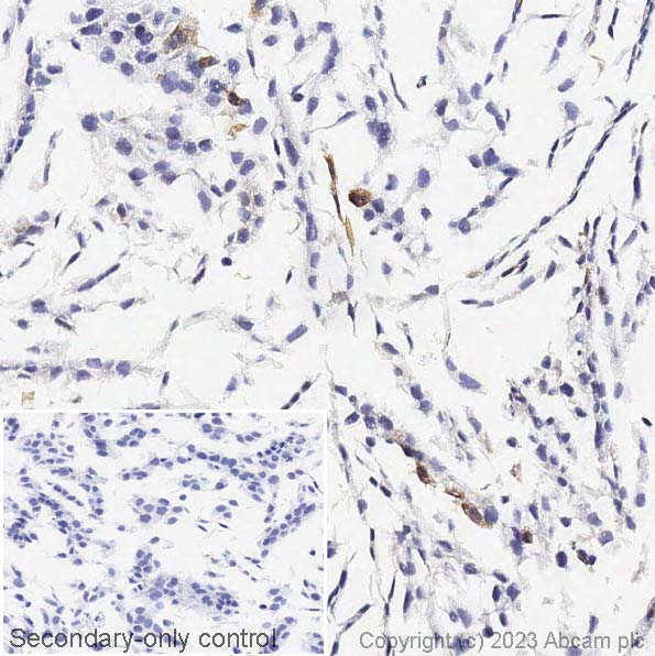 Immunohistochemistry (Formalin/PFA-fixed paraffin-embedded sections) - Anti-Cytokeratin 14 antibody [EPR1612] (AB108417), expandable thumbnail