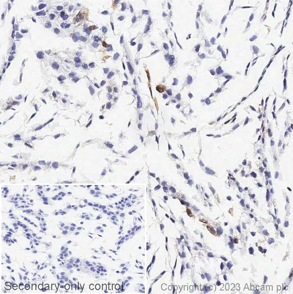 Immunohistochemistry (Formalin/PFA-fixed paraffin-embedded sections) - Anti-Cytokeratin 14 antibody [EPR1612] (AB108417)