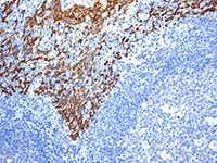 Immunohistochemistry (Formalin/PFA-fixed paraffin-embedded sections) - Anti-Cytokeratin 14 antibody [EPR1612] (AB108417), expandable thumbnail