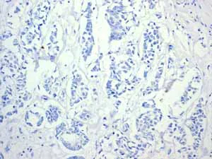 Immunohistochemistry (Formalin/PFA-fixed paraffin-embedded sections) - Anti-Cytokeratin 14 antibody [EPR1612] - BSA and Azide free (AB247664)