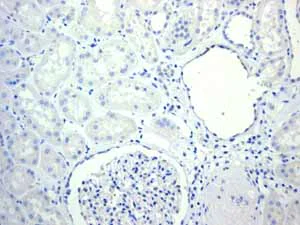 Immunohistochemistry (Formalin/PFA-fixed paraffin-embedded sections) - Anti-Cytokeratin 14 antibody [EPR1612] - BSA and Azide free (AB247664)