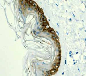 Immunohistochemistry (Formalin/PFA-fixed paraffin-embedded sections) - Anti-Cytokeratin 14 antibody [EPR1612] - BSA and Azide free (AB247664)