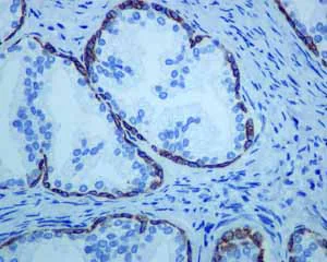 Immunohistochemistry (Formalin/PFA-fixed paraffin-embedded sections) - Anti-Cytokeratin 14 antibody [EPR1612] - BSA and Azide free (AB247664)