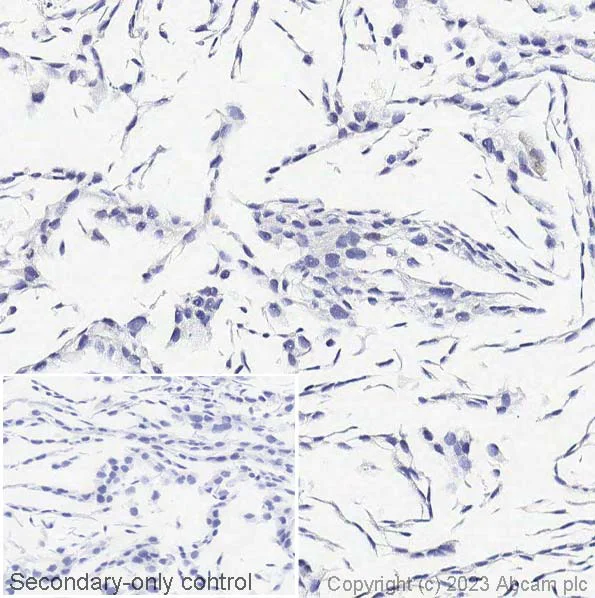 Immunohistochemistry (Formalin/PFA-fixed paraffin-embedded sections) - Anti-Cytokeratin 14 antibody [EPR1612] - BSA and Azide free (AB247664)