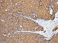 Immunohistochemistry (Formalin/PFA-fixed paraffin-embedded sections) - Anti-Cytokeratin 14 antibody [EPR1612] - BSA and Azide free (AB247664)