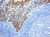 Immunohistochemistry (Formalin/PFA-fixed paraffin-embedded sections) - Anti-Cytokeratin 14 antibody [EPR1612] - BSA and Azide free (AB247664)