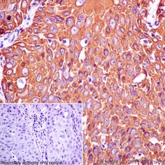 Immunohistochemistry (Formalin/PFA-fixed paraffin-embedded sections) - Anti-Cytokeratin 14 antibody [EPR17336] (AB197893)