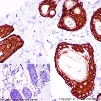 Immunohistochemistry (Formalin/PFA-fixed paraffin-embedded sections) - Anti-Cytokeratin 14 antibody [EPR17336] (AB197893)