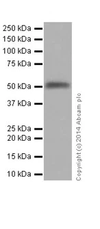 Western blot - Anti-Cytokeratin 14 antibody [EPR17336] (AB197893)