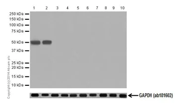 Western blot - Anti-Cytokeratin 14 antibody [EPR17336] (AB197893)