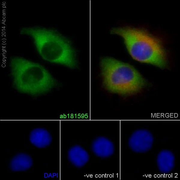 Immunocytochemistry/ Immunofluorescence - Anti-Cytokeratin 14 antibody [EPR17350] - Cytoskeleton Marker (AB181595)