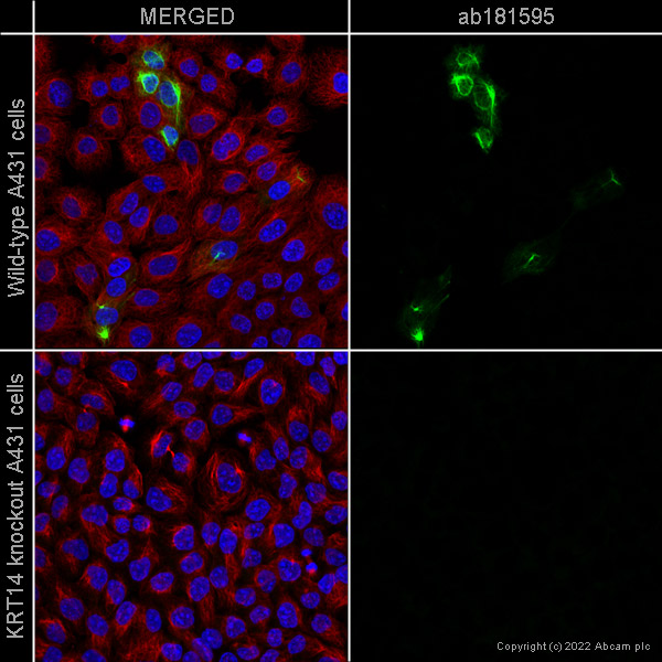 Immunocytochemistry/ Immunofluorescence - Anti-Cytokeratin 14 antibody [EPR17350] - Cytoskeleton Marker (ab181595), expandable thumbnail