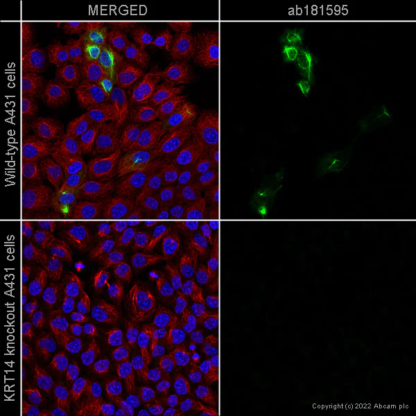 Immunocytochemistry/ Immunofluorescence - Anti-Cytokeratin 14 antibody [EPR17350] - Cytoskeleton Marker (AB181595)