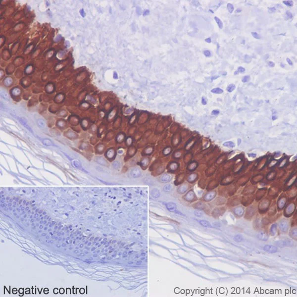 Immunohistochemistry (Formalin/PFA-fixed paraffin-embedded sections) - Anti-Cytokeratin 14 antibody [EPR17350] - Cytoskeleton Marker (AB181595)