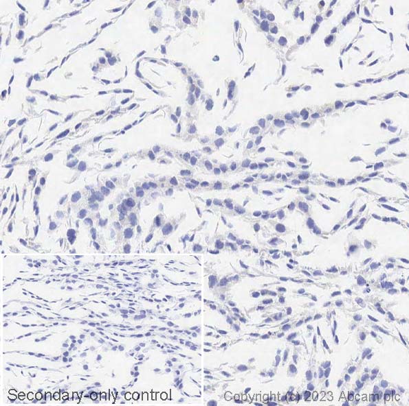 Immunohistochemistry (Formalin/PFA-fixed paraffin-embedded sections) - Anti-Cytokeratin 14 antibody [EPR17350] - Cytoskeleton Marker (ab181595), expandable thumbnail