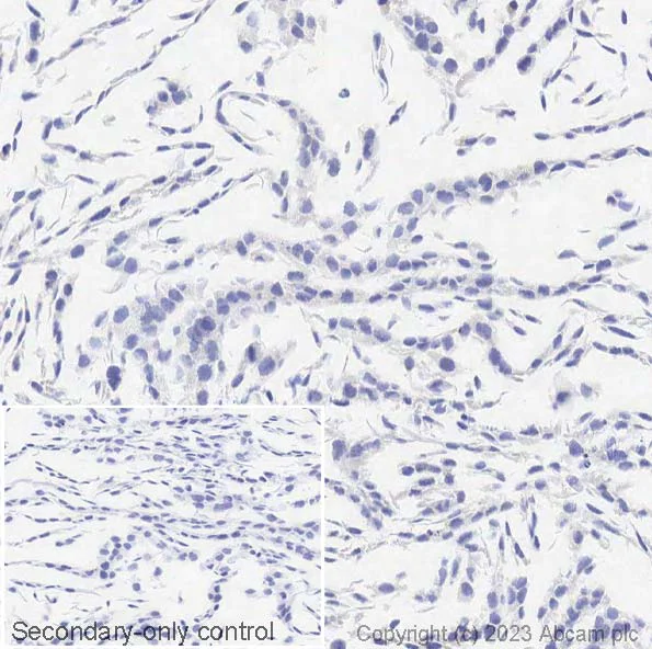 Immunohistochemistry (Formalin/PFA-fixed paraffin-embedded sections) - Anti-Cytokeratin 14 antibody [EPR17350] - Cytoskeleton Marker (AB181595)