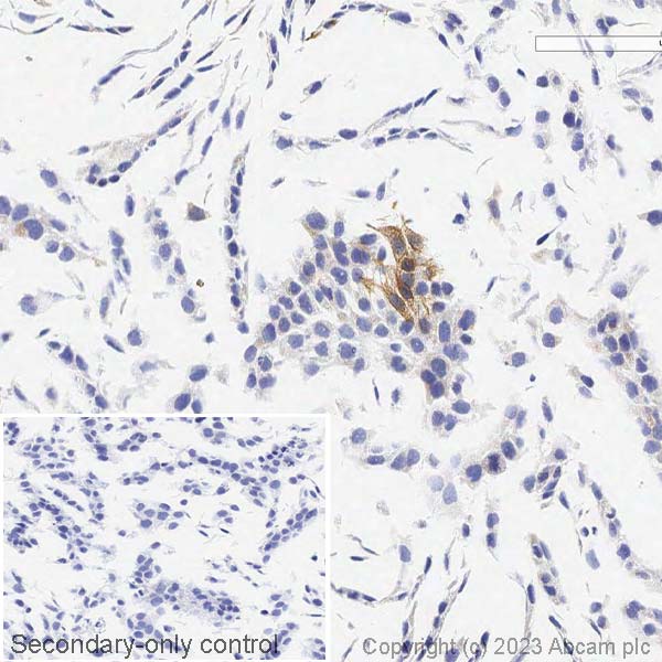 Immunohistochemistry (Formalin/PFA-fixed paraffin-embedded sections) - Anti-Cytokeratin 14 antibody [EPR17350] - Cytoskeleton Marker (ab181595), expandable thumbnail