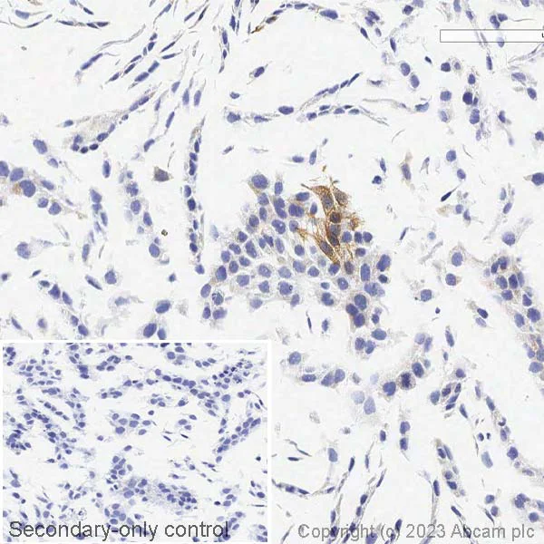 Immunohistochemistry (Formalin/PFA-fixed paraffin-embedded sections) - Anti-Cytokeratin 14 antibody [EPR17350] - Cytoskeleton Marker (AB181595)