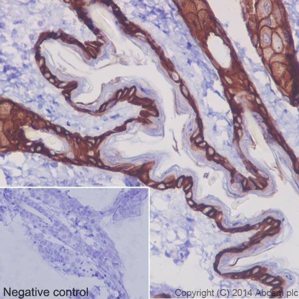 Immunohistochemistry (Formalin/PFA-fixed paraffin-embedded sections) - Anti-Cytokeratin 14 antibody [EPR17350] - Cytoskeleton Marker (ab181595), expandable thumbnail
