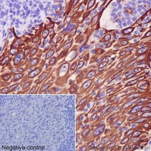 Immunohistochemistry (Formalin/PFA-fixed paraffin-embedded sections) - Anti-Cytokeratin 14 antibody [EPR17350] - Cytoskeleton Marker (AB181595)
