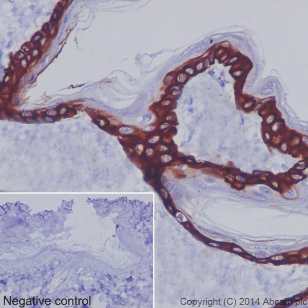 Immunohistochemistry (Formalin/PFA-fixed paraffin-embedded sections) - Anti-Cytokeratin 14 antibody [EPR17350] - Cytoskeleton Marker (ab181595), expandable thumbnail
