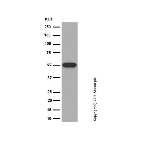 Western blot - Anti-Cytokeratin 14 antibody [EPR17350] - Cytoskeleton Marker (ab181595), expandable thumbnail