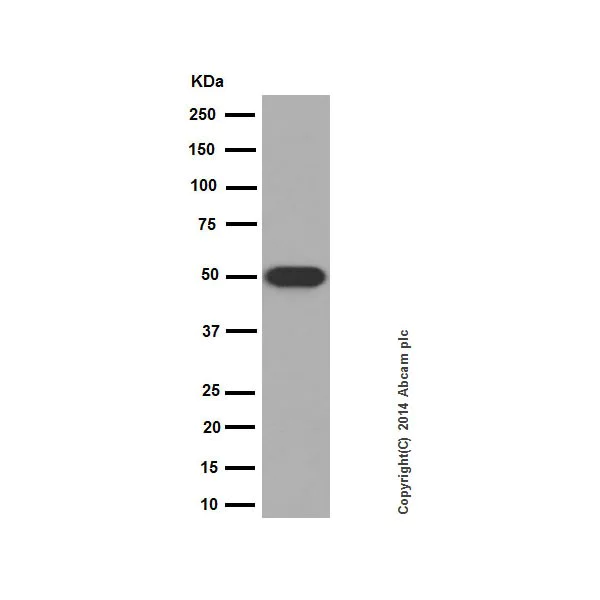 Western blot - Anti-Cytokeratin 14 antibody [EPR17350] - Cytoskeleton Marker (AB181595)