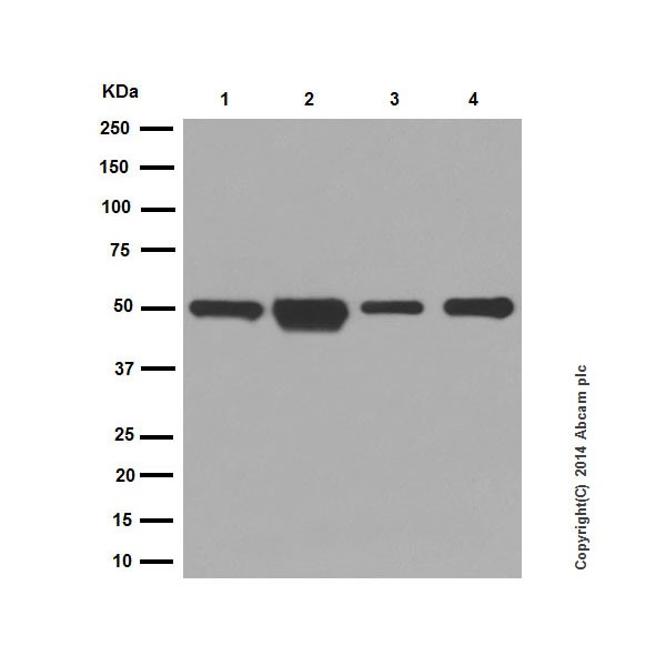 Western blot - Anti-Cytokeratin 14 antibody [EPR17350] - Cytoskeleton Marker (AB181595), expandable thumbnail
