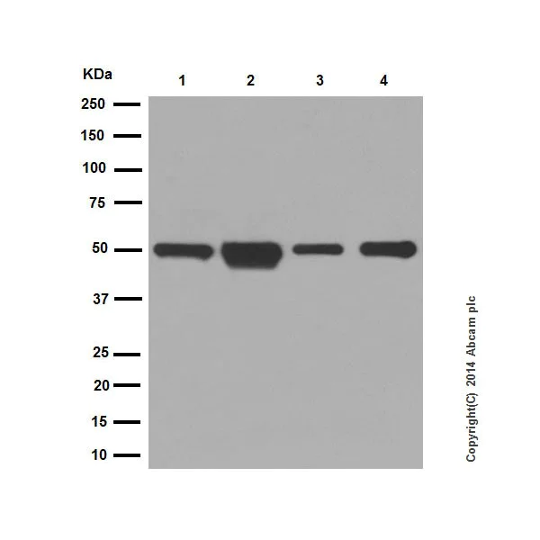 Western blot - Anti-Cytokeratin 14 antibody [EPR17350] - Cytoskeleton Marker (AB181595)