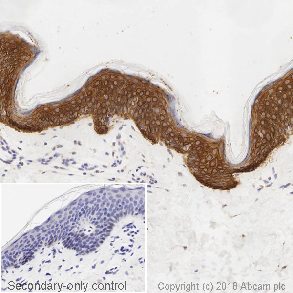 Immunohistochemistry (Formalin/PFA-fixed paraffin-embedded sections) - Anti-Cytokeratin 14 antibody [LL002] (AB7800), expandable thumbnail