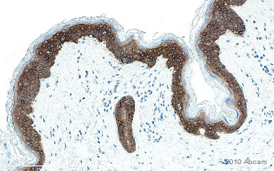 Immunohistochemistry (Formalin/PFA-fixed paraffin-embedded sections) - Anti-Cytokeratin 14 antibody [LL002] (AB7800), expandable thumbnail