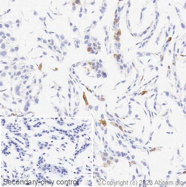Immunohistochemistry (Formalin/PFA-fixed paraffin-embedded sections) - Anti-Cytokeratin 14 antibody [LL002] (ab7800), expandable thumbnail