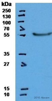 Western blot - Anti-Cytokeratin 14 antibody [LL002] (AB7800), expandable thumbnail