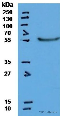 Western blot - Anti-Cytokeratin 14 antibody [LL002] (AB7800)