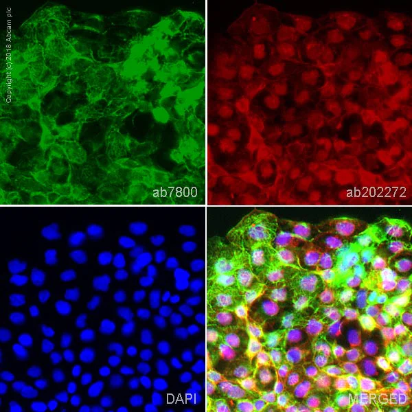 Immunocytochemistry/ Immunofluorescence - Anti-Cytokeratin 14 antibody [LL002] - BSA and Azide free (AB212547)