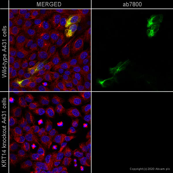 Immunocytochemistry/ Immunofluorescence - Anti-Cytokeratin 14 antibody [LL002] - BSA and Azide free (AB212547)