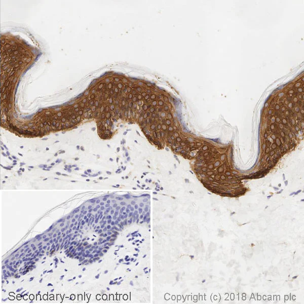 Immunohistochemistry (Formalin/PFA-fixed paraffin-embedded sections) - Anti-Cytokeratin 14 antibody [LL002] - BSA and Azide free (AB212547)