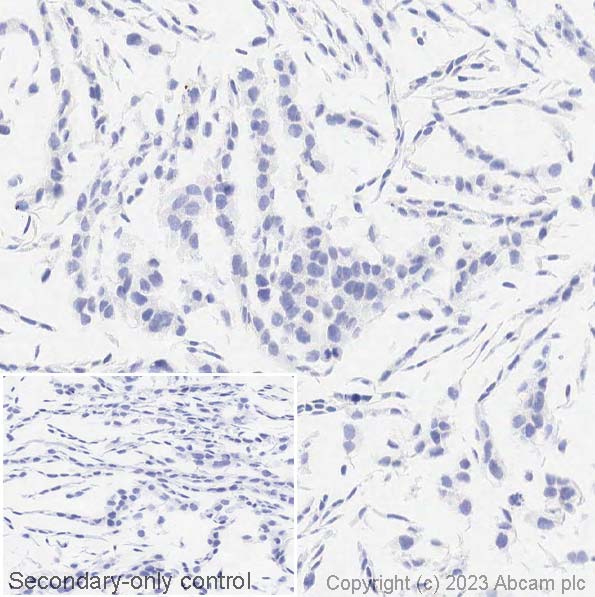 Immunohistochemistry (Formalin/PFA-fixed paraffin-embedded sections) - Anti-Cytokeratin 14 antibody [LL002] - BSA and Azide free (AB212547)