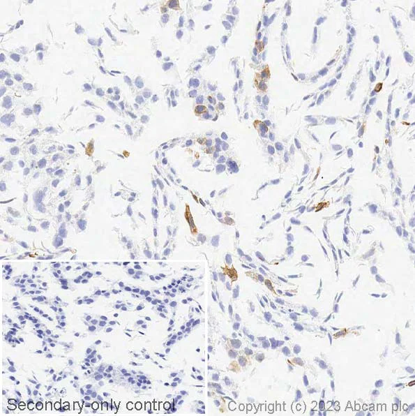 Immunohistochemistry (Formalin/PFA-fixed paraffin-embedded sections) - Anti-Cytokeratin 14 antibody [LL002] - BSA and Azide free (AB212547)