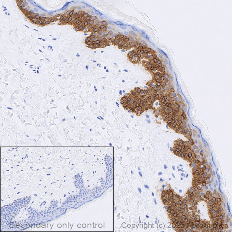 Immunohistochemistry (Formalin/PFA-fixed paraffin-embedded sections) - Anti-Cytokeratin 14 antibody [LL002] - BSA and Azide free (AB212547)
